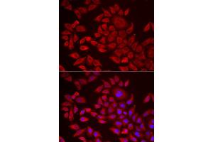Immunofluorescence analysis of HeLa cell using AGPAT2 antibody. (AGPAT2 anticorps)