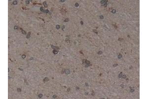 Detection of CNX in Human Brain Tissue using Polyclonal Antibody to Calnexin (CNX)