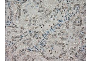 Image no. 11 for anti-Neurotrophic tyrosine Kinase, Receptor, Type 3 (NTRK3) antibody (ABIN1499842)