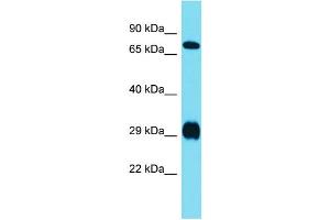 Host:  Rabbit  Target Name:  Prrxl1  Sample Type:  Rat Liver lysates  Antibody Dilution:  1.
