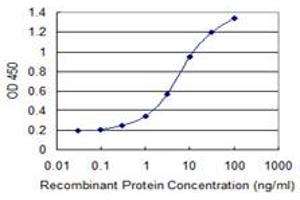 Detection limit for recombinant GST tagged AIPL1 is 0. (AIPL1 anticorps  (AA 1-384))