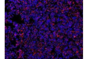 IF analysis of MYD88 using anti-MYD88 antibody (ABIN3043887) MYD88 was detected in paraffin-embedded section of human tonsil tissues.