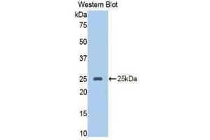 Western Blotting (WB) image for anti-serpin Peptidase Inhibitor, Clade A (Alpha-1 Antiproteinase, Antitrypsin), Member 10 (SERPINA10) (AA 278-425) antibody (ABIN1860973) (SERPINA10 anticorps  (AA 278-425))