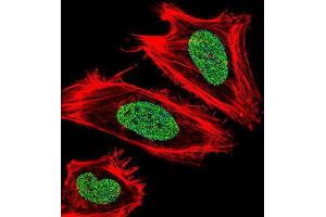 Immunofluorescence (IF) image for anti-Ubiquitin-Like, Containing PHD and RING Finger Domains, 1 (UHRF1) antibody (ABIN3003938) (UHRF1 anticorps)
