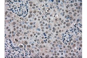 anti-Transmembrane Protein 100 (TMEM100) antibody