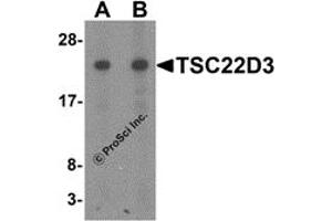 Western Blotting (WB) image for anti-TSC22 Domain Family, Member 3 (TSC22D3) (N-Term) antibody (ABIN1077436) (TSC22D3 anticorps  (N-Term))
