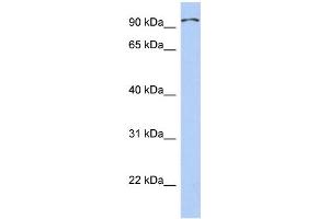 WB Suggested Anti-TRPC4AP Antibody Titration: 0.