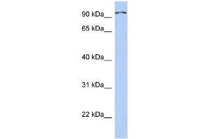 WB Suggested Anti-TRPC4AP Antibody Titration: 0. (TRPC4AP anticorps  (Middle Region))