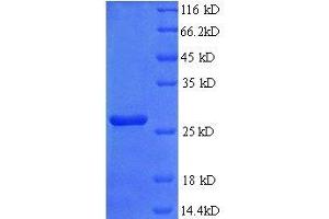 Protein expressed in E.