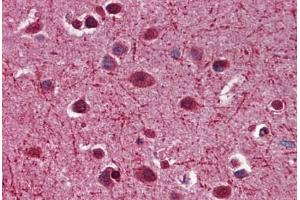 Human Brain, Cortex: Formalin-Fixed, Paraffin-Embedded (FFPE)