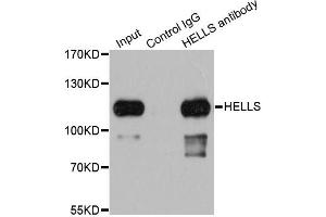 Immunoprecipitation analysis of 200 μg extracts of 293T cells using 1 μg HELLS antibody (ABIN5973444). (HELLS anticorps)