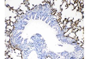 IHC analysis of Periostin using anti-Periostin antibody .