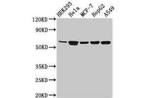 Western Blot Positive WB detected in: HEK293 whole cell lysate, Hela whole cell lysate, MCF-7 whole cell lysate, HepG2 whole cell lysate, A549 whole cell lysate All lanes: CYP4F22 antibody at 3. (CYP4F22 anticorps  (AA 413-507))