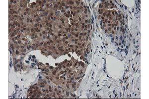 Immunohistochemistry (IHC) image for anti-Destrin (Actin Depolymerizing Factor) (DSTN) antibody (ABIN1497908)