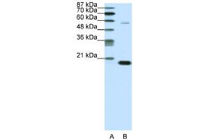 WB Suggested Anti-CBX3 Antibody Titration:  0. (CBX3 anticorps  (Middle Region))