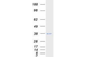 Validation with Western Blot