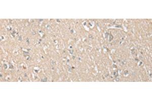 Immunohistochemistry of paraffin-embedded Human brain tissue using ECI1 Polyclonal Antibody at dilution of 1:30(x200) (DCI anticorps)
