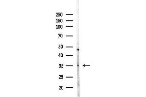 Western blot analysis of lysates from HepG2 cells(LPS, 4h treatment), using C1QTNF9B Antibody at 1/1000 dilution. (C1QTNF9B anticorps)