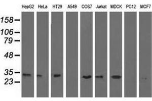Western blot analysis of extracts (35 µg) from 9 different cell lines by using anti-ERCC1 monoclonal antibody. (ERCC1 anticorps)