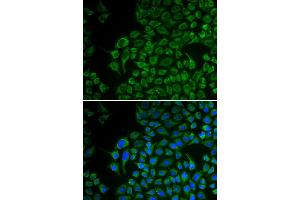 Immunofluorescence analysis of U2OS cell using TYR antibody. (TYR anticorps)