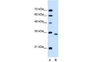 ACVR2B antibody used at 0.