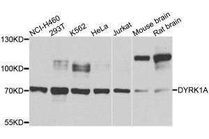 Western blot analysis of extracts of various cell lines, using DYRK1A antibody. (DYRK1A anticorps  (AA 624-763))