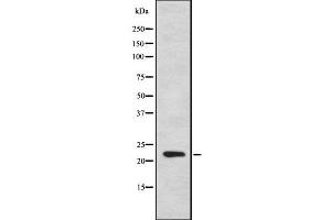 Western blot analysis IFNA7 using HepG2 whole cell lysates