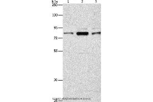 Western blot analysis of Human brain malignant glioma tissue, A172 and 293T cell, using ARHGEF7 Polyclonal Antibody at dilution of 1:800