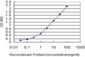 Detection limit for recombinant GST tagged RNF181 is approximately 0.