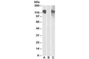 Western blot testing of HEK293 lysate overexpressing CDH11-MYC with CDH11 antibody [1ug/ml] in Lane A and with anti-MYC [1/1000] in lane C. (OB Cadherin anticorps)