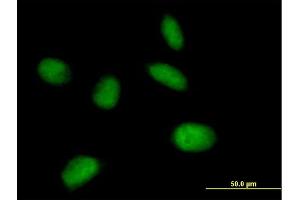 Immunofluorescence of purified MaxPab antibody to MIS12 on HeLa cell. (MIS12 anticorps  (AA 1-205))