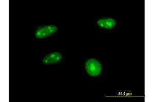 Immunofluorescence of purified MaxPab antibody to APTX on HeLa cell. (Aprataxin anticorps  (AA 1-254))
