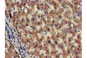 Immunohistochemistry of paraffin-embedded human liver tissue using ABIN7155985 at dilution of 1:100