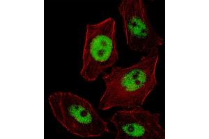 Fluorescent image of  cell stained with PHOX2B Antibody (Center) (ABIN655288 and ABIN2844878). (PHOX2B anticorps  (AA 104-130))