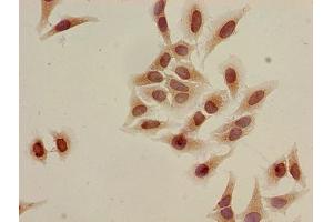 Immunocytochemistry analysis of Hela cells using ABIN7139205 at dilution of 1:100 (HIST1H3A anticorps  (H3K9ac))
