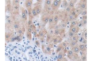 Detection of NCCT in Human Liver Tissue using Polyclonal Antibody to Na-Cl Cotransporter (NCCT)