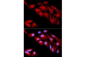 Immunofluorescence analysis of U2OS cell using CTNND1 antibody. (CTNND1 anticorps  (AA 573-832))