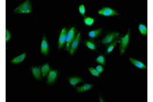 Immunofluorescence staining of Hela cells with ABIN7154130 at 1:260, counter-stained with DAPI. (CHAC1 anticorps  (AA 43-264))