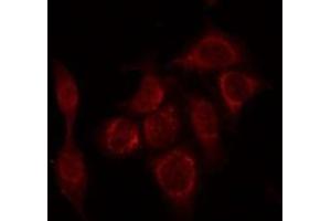 ABIN6266732 staining HepG2 by IF/ICC. (PTTG1 anticorps  (Internal Region))
