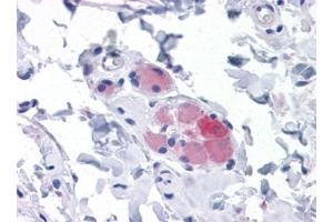 Immunohistochemistry (IHC) image for anti-Stromal Interaction Molecule 1 (STIM1) (AA 24-686) antibody (ABIN614666)