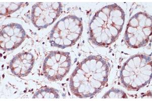 Immunohistochemistry of paraffin-embedded Human colon using S100A5 Polyclonal Antibody at dilution of 1:100 (40x lens). (S100A5 anticorps)