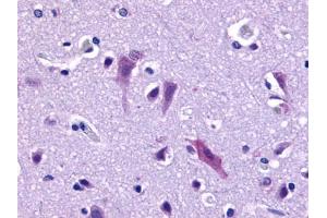 Anti-QRFPR / GPR103 antibody IHC of human brain, neurons and glia.