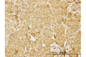 Image no. 2 for anti-Neural Wiskott-Aldrich syndrome protein (WASL) (AA 97-185) antibody (ABIN598590) (Neural Wiskott-Aldrich syndrome protein (WASL) (AA 97-185) anticorps)