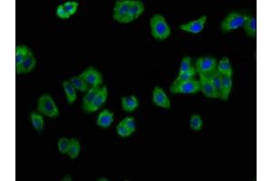 Immunofluorescence staining of HepG2 cells with ABIN7156777 at 1:133, counter-stained with DAPI. (IL12RB2 anticorps  (AA 366-470))