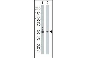 The anti-KIST Pab (ABIN6243411 and ABIN6578980) is used in Western blot to detect KIST in K562 cell lysate (Lane 1) and mouse liver tissue lysate (Lane 2). (UHMK1 anticorps  (C-Term))