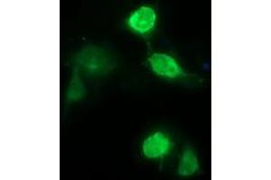 Image no. 3 for anti-CD163 (CD163) antibody (ABIN1497170) (CD163 anticorps)