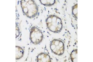 Immunohistochemistry of paraffin-embedded human colon using ACCS antibody (ABIN6293455) at dilution of 1:200 (40x lens). (PHACS anticorps)