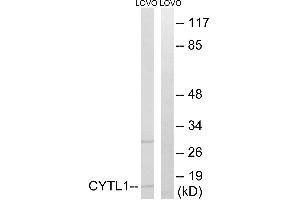 Immunohistochemistry analysis of paraffin-embedded human brain tissue using CYTL1 antibody.