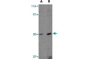 Western blot analysis of FEZ2 in mouse brain tissue lysate with FEZ2 polyclonal antibody  at (A) 0. (FEZ2 anticorps  (C-Term))