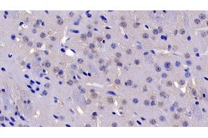 Detection of CASP3 in Mouse Cerebrum Tissue using Polyclonal Antibody to Caspase 3 (CASP3)